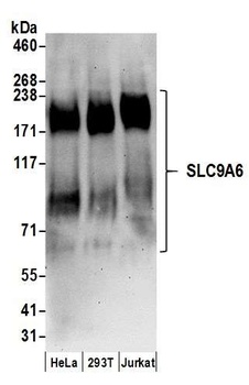 Rabbit anti-SLC9A6 Antibody