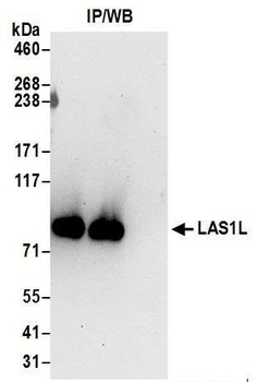 LAS1L Antibody