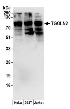 Rabbit anti-TGOLN2 Antibody