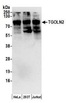 TGOLN2 Antibody