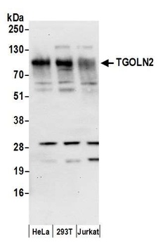 TGOLN2 Antibody