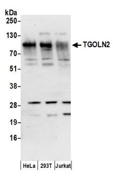 Rabbit anti-TGOLN2 Antibody