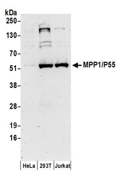 MPP1/P55 Antibody
