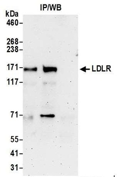 LDLR Antibody