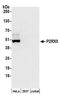 P2RX5 Antibody