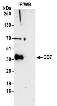 CD7 Antibody