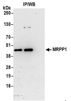 MRPP1 Antibody