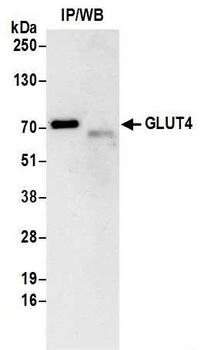 GLUT4 Antibody