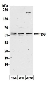 TDG Antibody