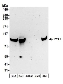 Rabbit anti-PYGL Antibody