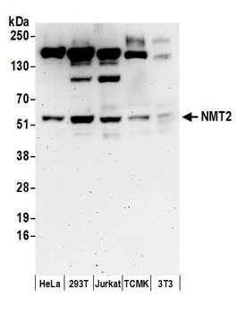 NMT2 Antibody