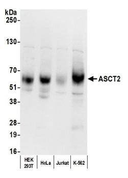 Rabbit anti-ASCT2 Antibody
