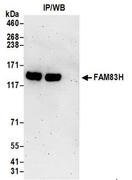 FAM83H Antibody