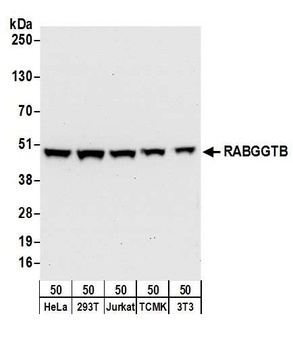 Rabbit anti-RABGGTB Antibody