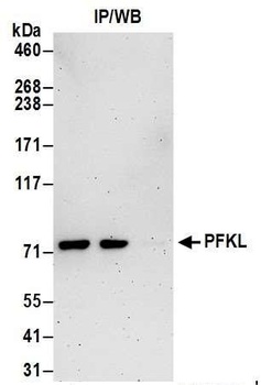 PFKL Antibody