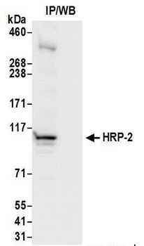 HRP-2 Antibody