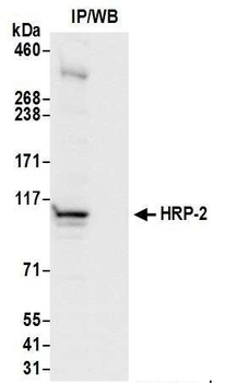 Rabbit anti-HRP-2 Antibody