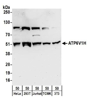 ATP6V1H Antibody