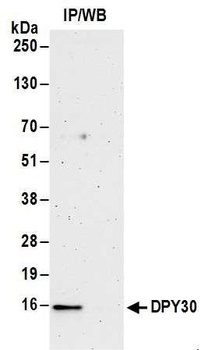 DPY30 Antibody