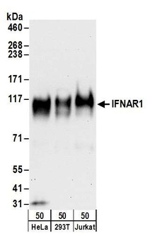 IFNAR1 Antibody