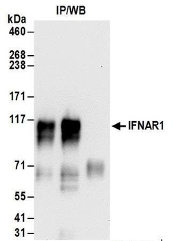 IFNAR1 Antibody