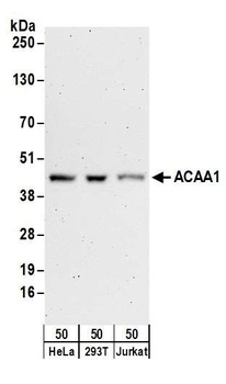 ACAA1 Antibody