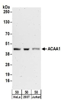 Rabbit anti-ACAA1 Antibody