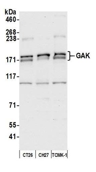 GAK Antibody