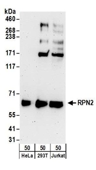 RPN2 Antibody
