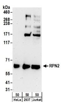 Rabbit anti-RPN2 Antibody