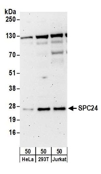 Rabbit anti-SPC24 Antibody