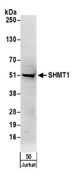 SHMT1 Antibody