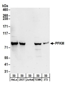 PFKM Antibody
