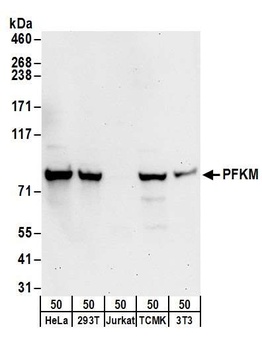 Rabbit anti-PFKM Antibody