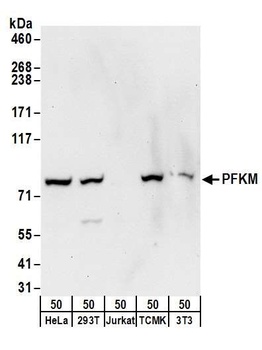 Rabbit anti-PFKM Antibody