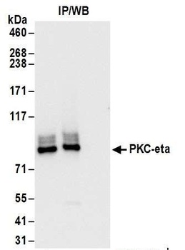 PKC-eta Antibody