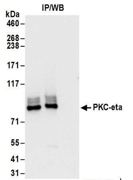Rabbit anti-PKC-eta Antibody