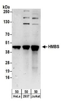 HMBS Antibody