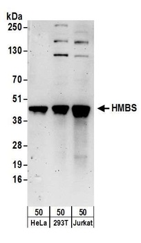 Rabbit anti-HMBS Antibody