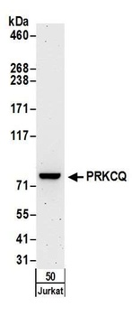 PRKCQ Antibody