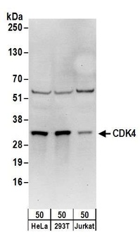 Rabbit anti-CDK4 Antibody