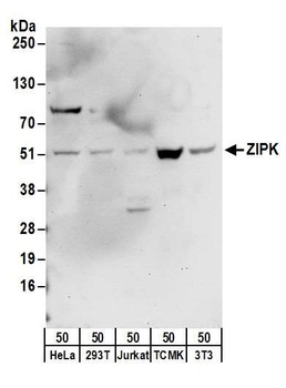 ZIPK Antibody
