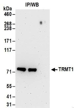 Rabbit anti-TRMT1 Antibody