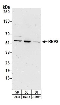 RRP8 Antibody
