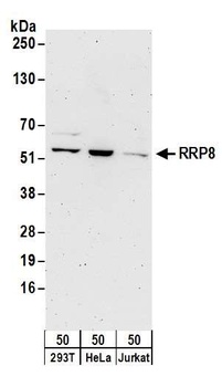 Rabbit anti-RRP8 Antibody