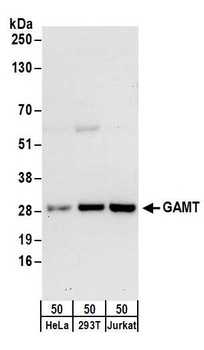 GAMT Antibody