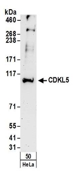 CDKL5 Antibody
