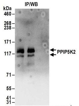 Rabbit anti-PPIP5K2 Antibody