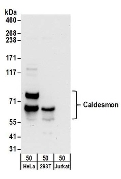 Rabbit anti-Caldesmon Antibody