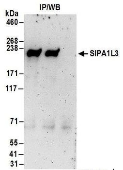 SIPA1L3 Antibody